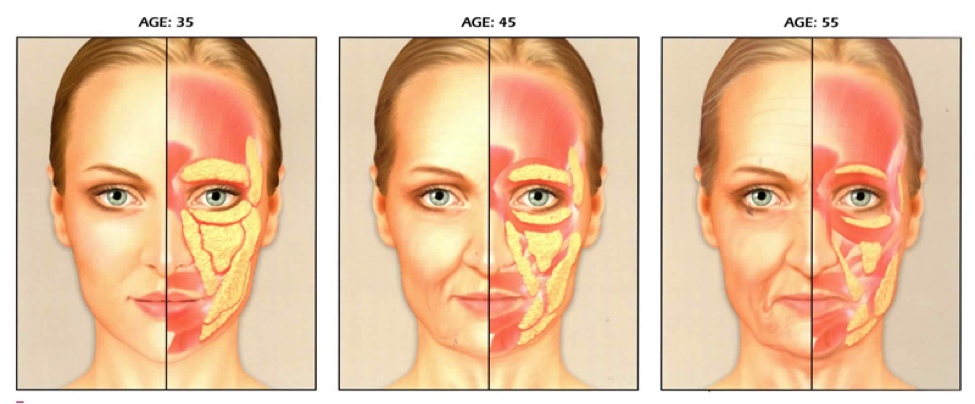 3Stages