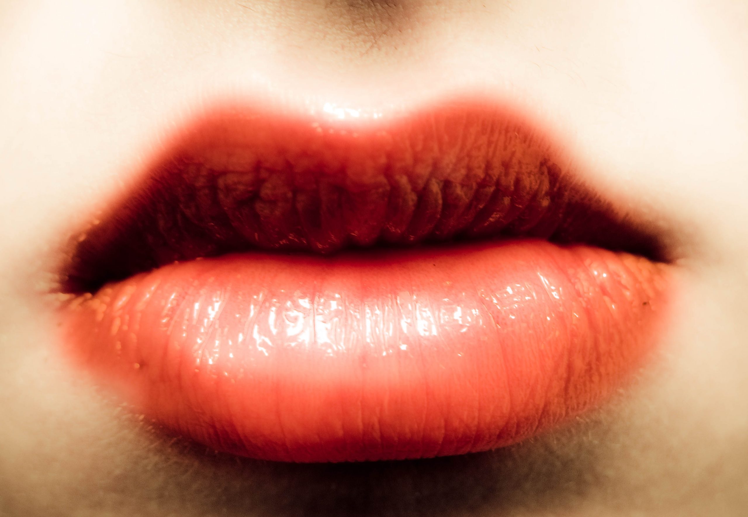 lip fillers los angeles