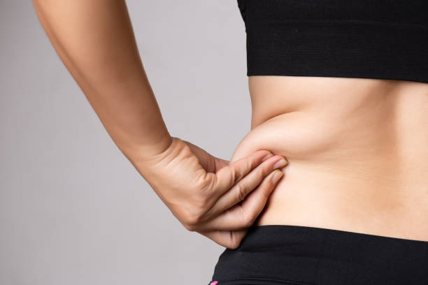 Tummy Tuck vs. Liposuction