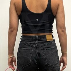 Arm Liposuction Before & After Patient #3862