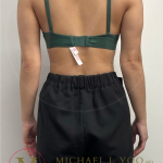 Arm Liposuction Before & After Patient #4463